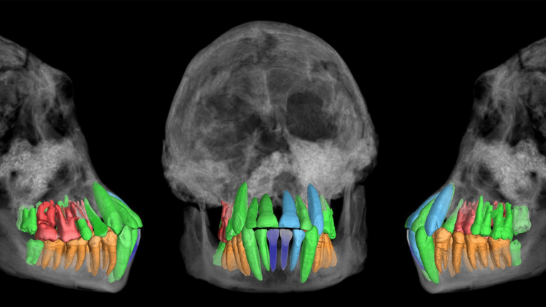 hominin skull reconstruction