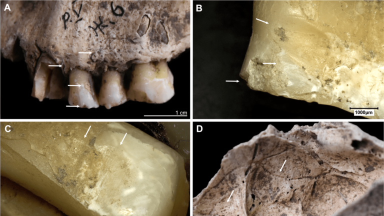 teeth part